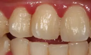 dentist in sydney