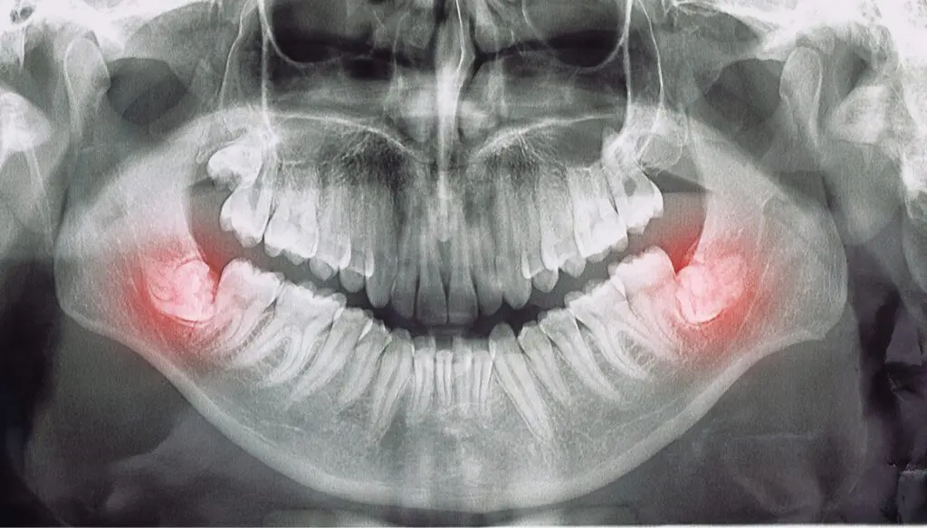 dentist in sydney