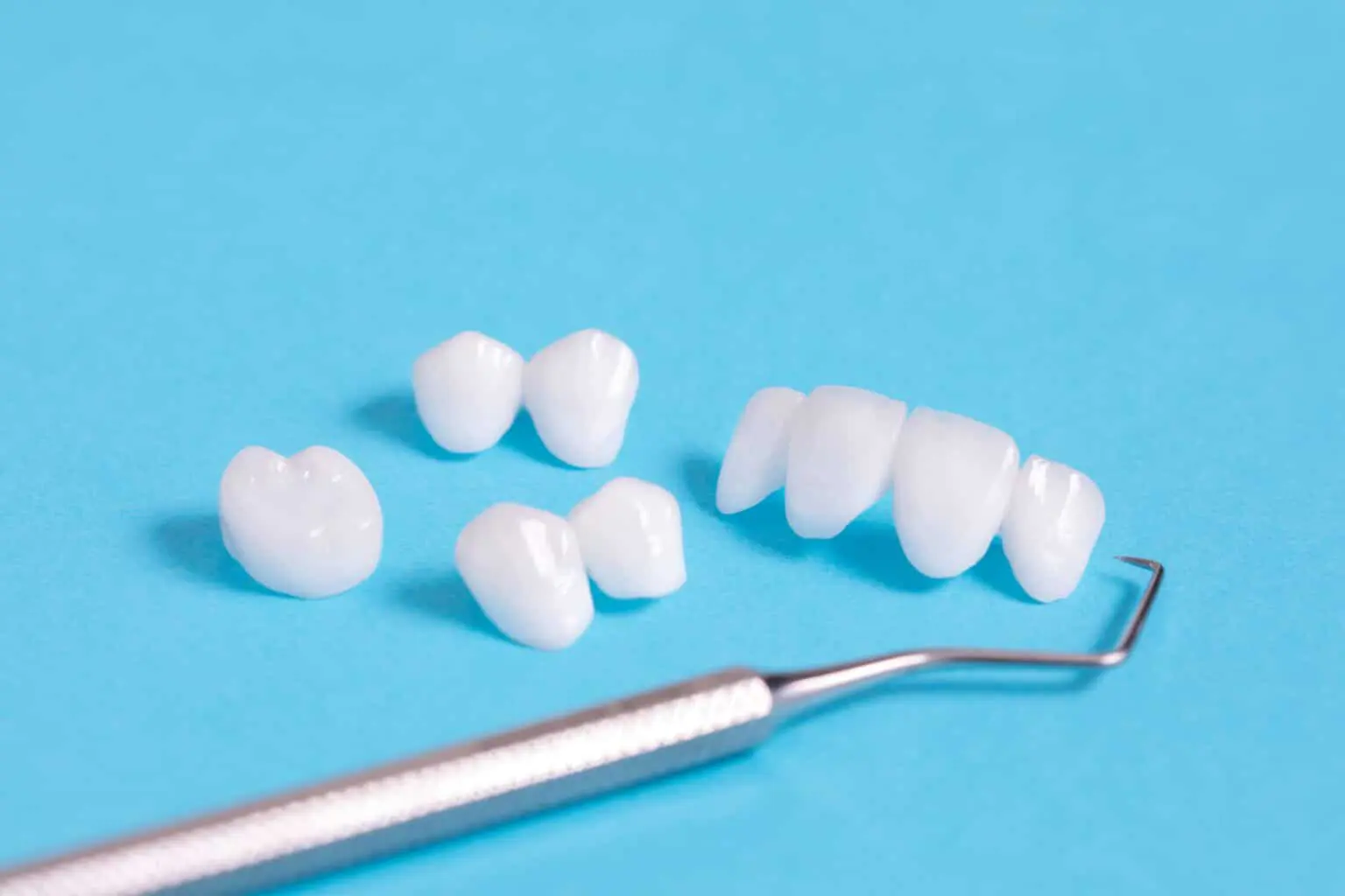 dental bonding in Sydney