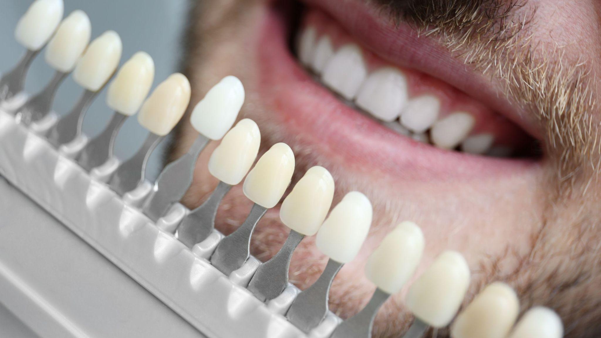 Tooth Sensitivity