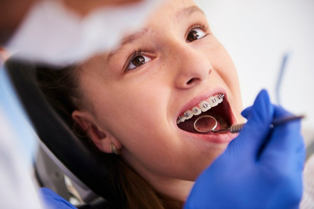Braces Sydney: Digital Orthodontics Services For Early and Adult​