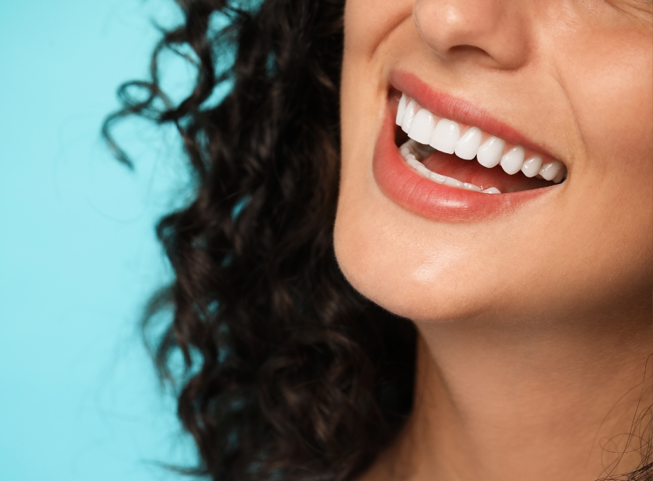 Dental Bonding Cost Sydney