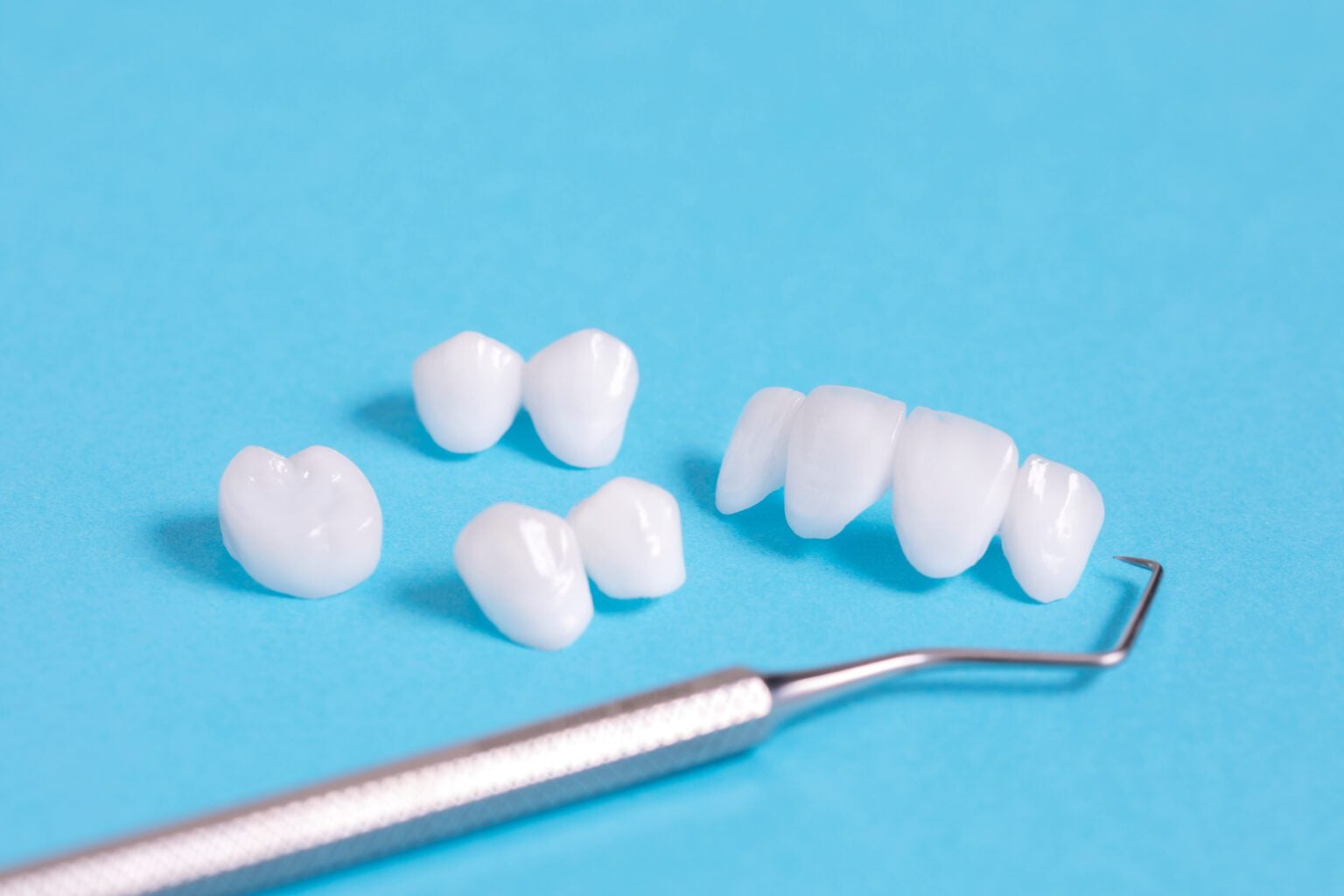 dental bonding in Sydney